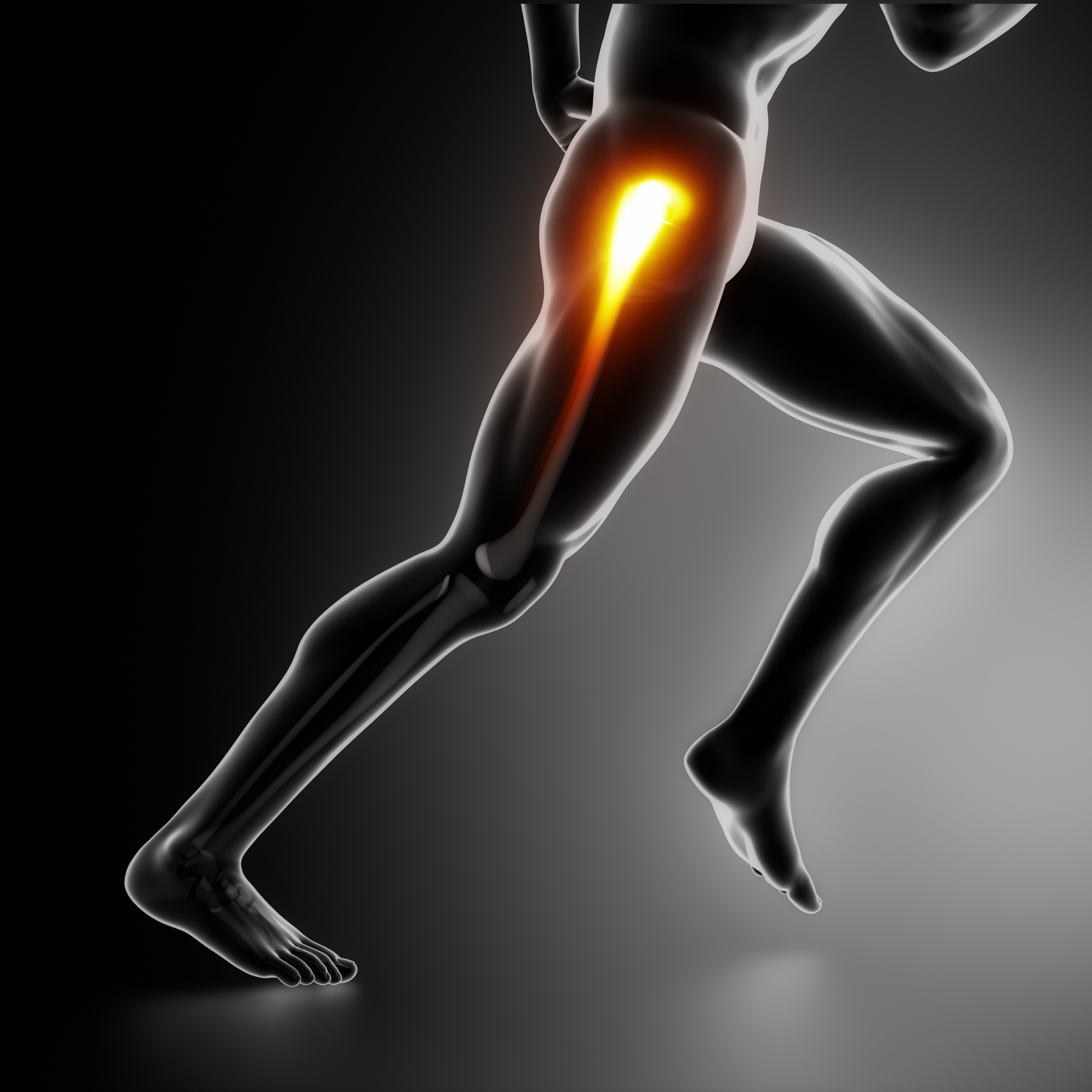 Sports medicine