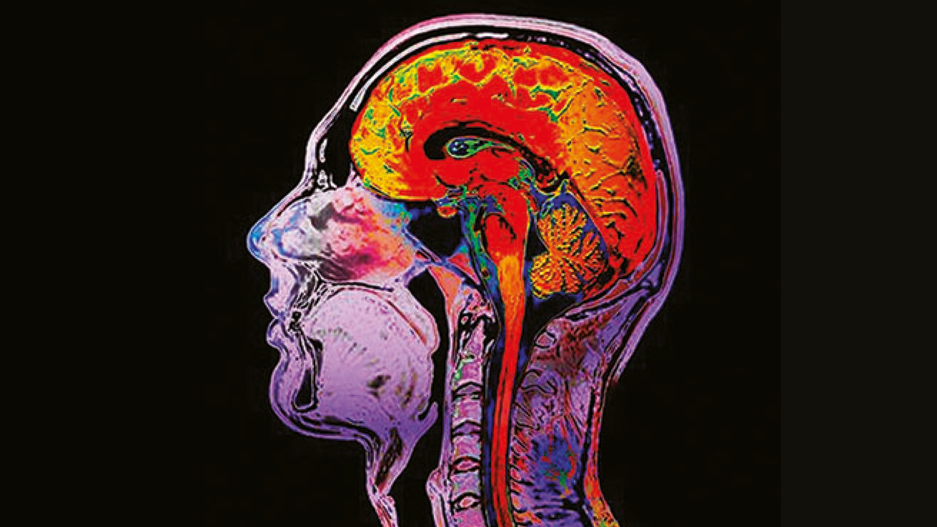 Neurology Action Plan